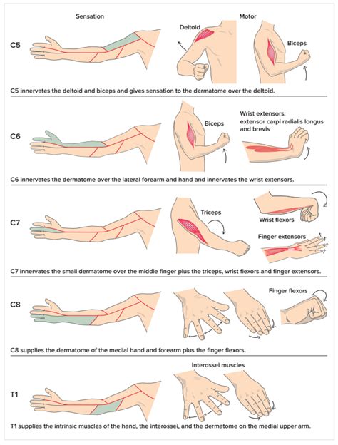 cervical radiculopathy compression test|cervical radiculopathy prognosis.